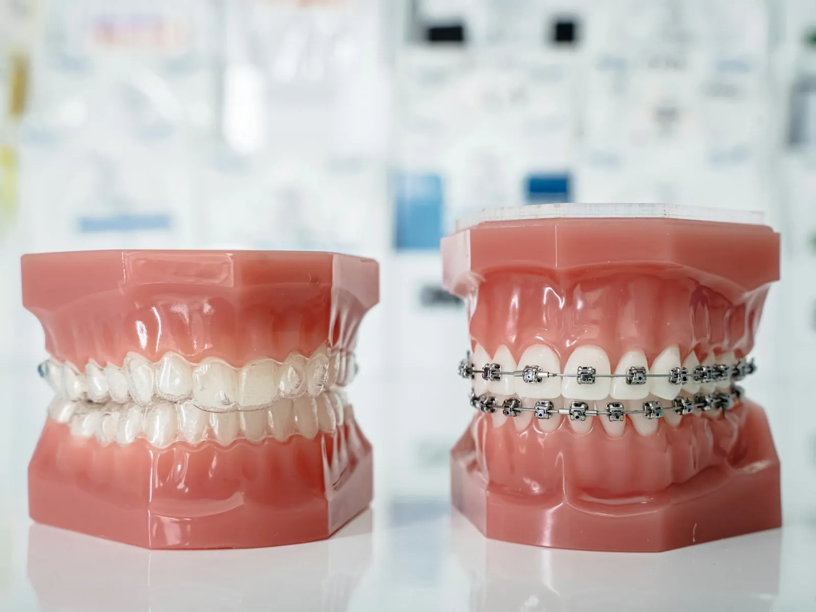 Ortodoncia: brackets, arcos, ligaduras, tubos